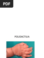 MALFORMACIONES GENETICAS