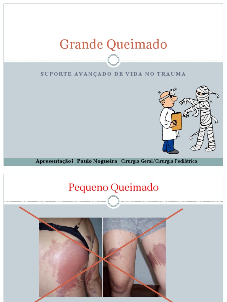 Grande Queimado 2011 | PDF | Queimadura | Monóxido de carbono