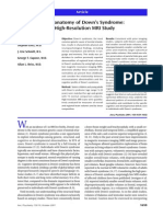 Neuroanatomy of Down's Syndrome: A High-Resolution MRI Study