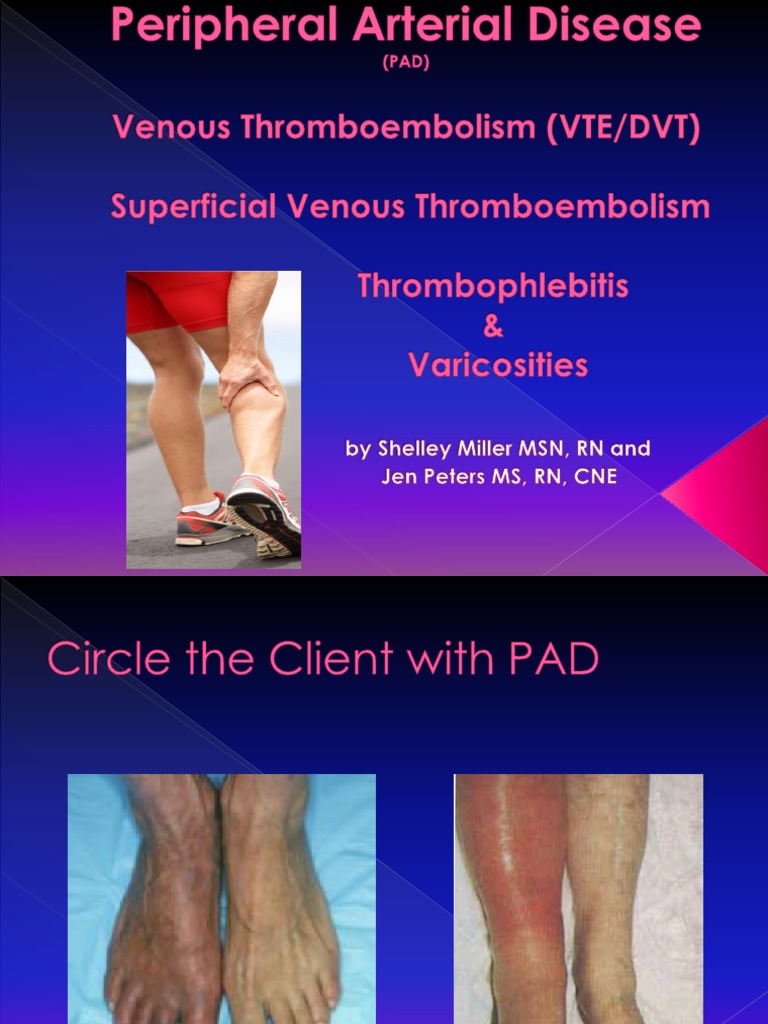 Peripheral Arterial Disease | PDF | Thrombosis | Vein