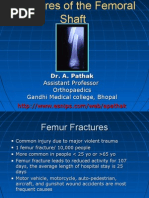 Download Fracture Shaft Femur by drabhishekortho SN24650571 doc pdf