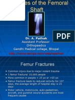 Download Fracture Shaft Femur by drabhishekortho SN24650571 doc pdf