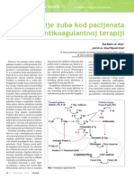 Ekstrakcija Kod Pacijenata Na Antikoagulansima