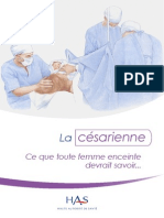 Accouchement Par Cesarienne