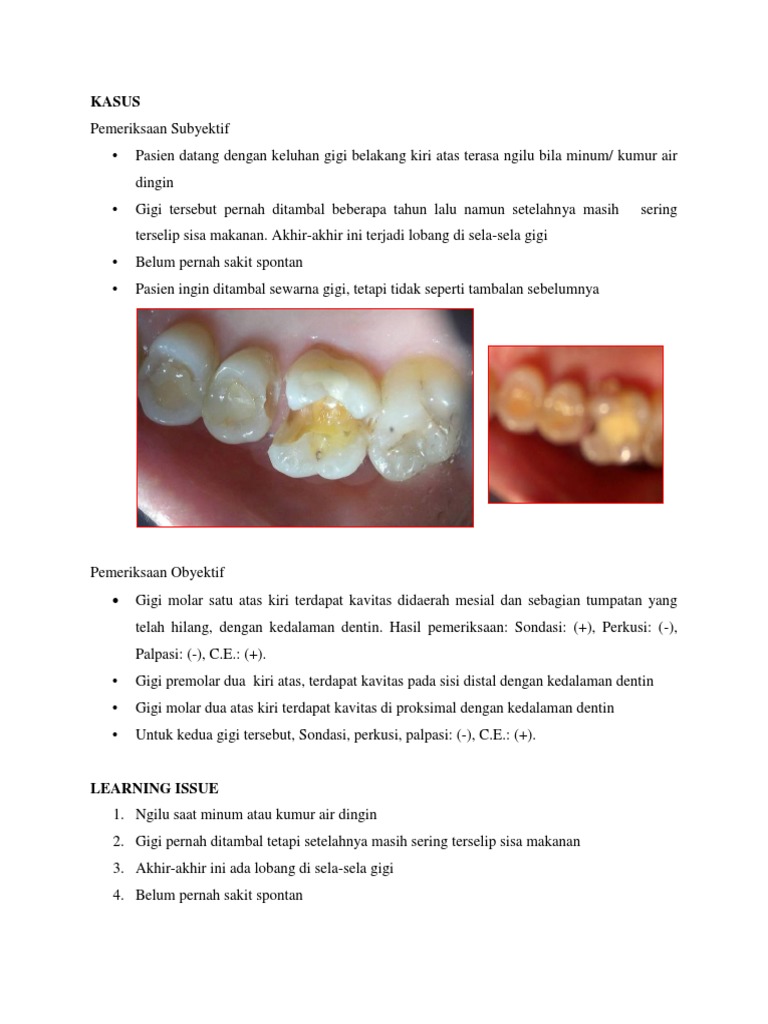 Passiv gomoseksualning anus teshigi