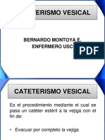 Cateterismo