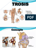 Fisiopatología artrosis 6 causas tratamiento prevención