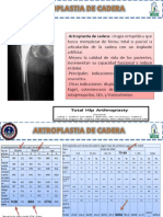 Caso Hoy