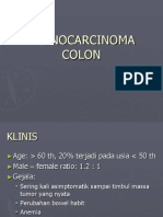 Adenocarcinoma Colon