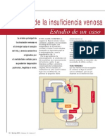 Revisión de La Insuficiencia Venosa