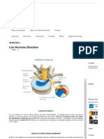 Fisioterapia - Las Hernias Discales