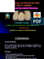 Coronas Veneer