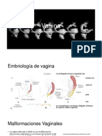 Neoplasia Intraepitelias Vaginal y Carcinoma Escamoso