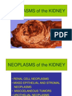 Uki 3 Neoplasms New of The Kidney Modf