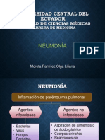 Neumonía: causas, factores de riesgo, diagnóstico y tratamiento