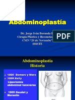 Abdominoplastía