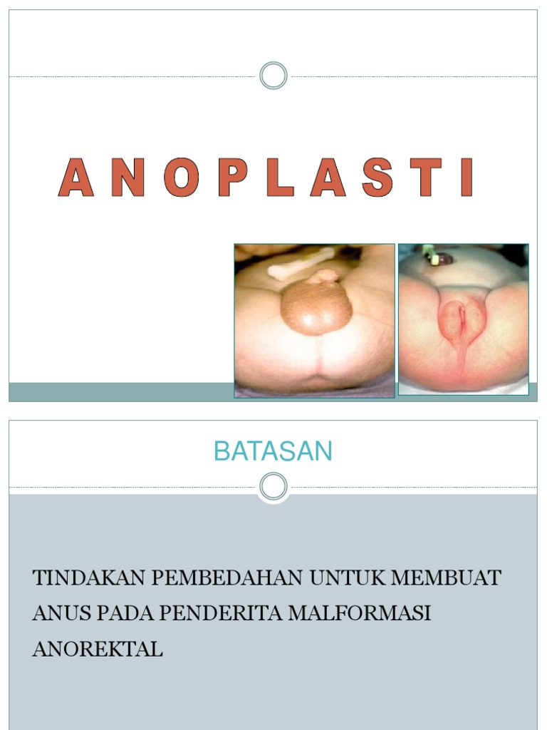 Laura Sinklerning onlayn pornosi: Ehtirosning narxi