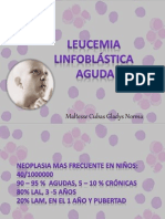 leucemia aguda linfoblastica