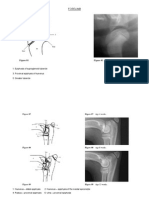 Forelimb: 1: Epiphysis of Supraglenoid Tubercle 3: Proximal Epiphysis of Humerus 5: Greater Tubercle