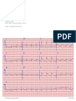 EKG of a 40 years ols person