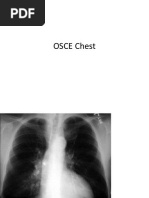 Osce Chest