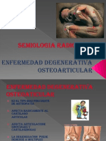 5.-Enfermedad Articular Degenerativa