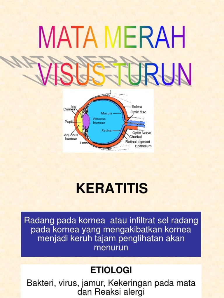 Mata-Merah-Visus-Turun-Ppt