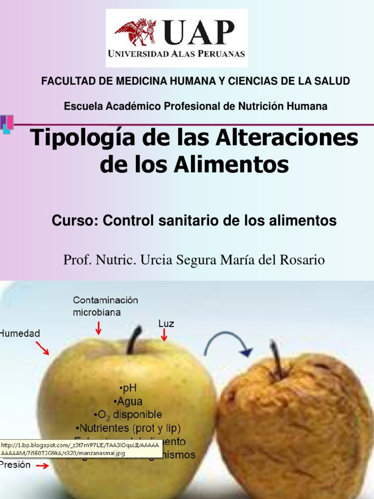 Principales Causas De Alteración De Los Alimentos – XHYY