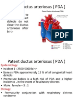 Patent Ductus Arteriosus (PDA)
