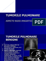 Curs Tumori Pulmonare (1)