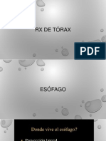 RX de tórax