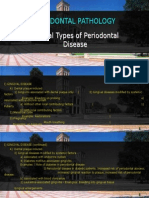 4 Gingivitis Classification Etiology Pathogenesis