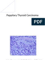 HistoPatology CA Thyroid