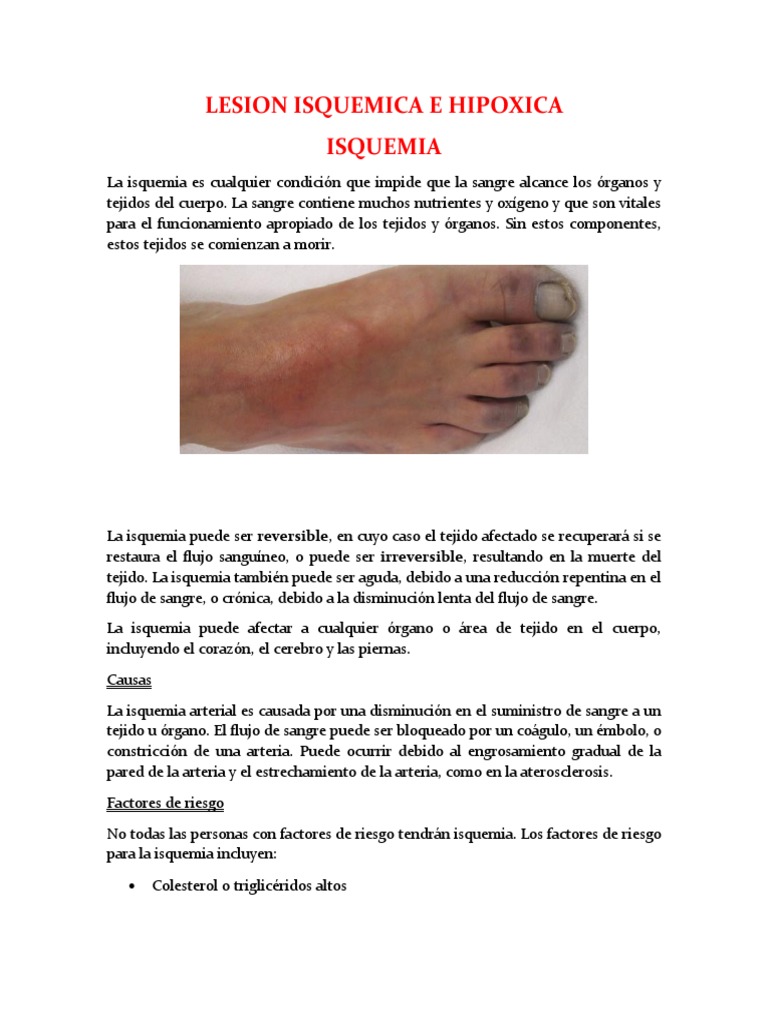 Diferencias entre Isquemia e Hipoxia | PDF | Isquemia | Hipoxia (médica)