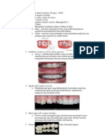 3 Utama Aplikasi Dental Ceramic Mahkota, Inlay, Veneer