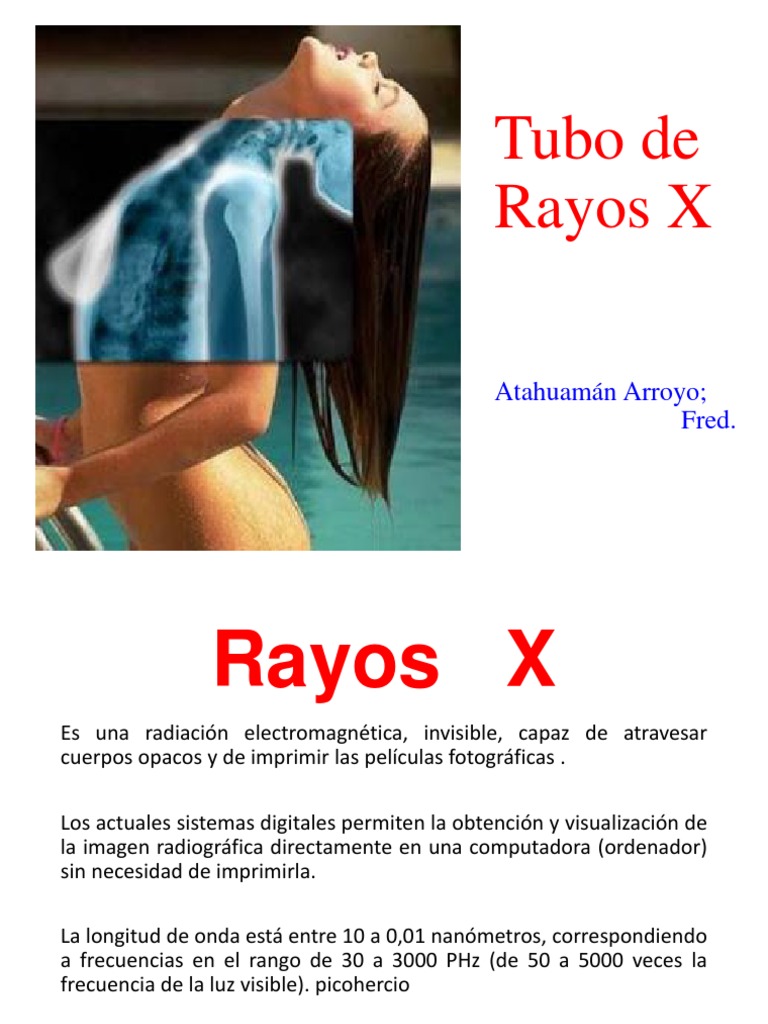 3. Tubo de Rayos X