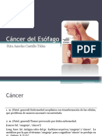 Cáncer Del Esófago