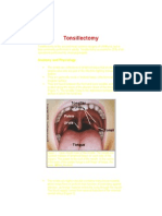 Tonsillectomy: Anatomy and Physiology