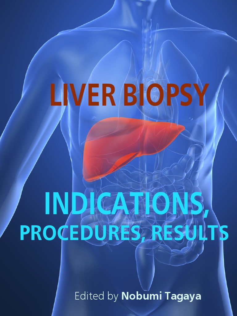 Liver Biopsy Indications, Procedures, Results N. Tagaya (Intech