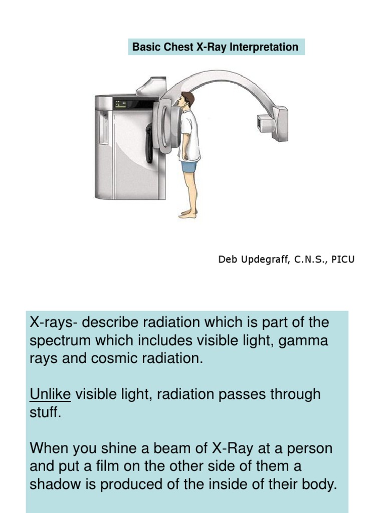 Chest X Ray, Introduction | PDF | Science & Mathematics