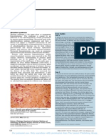 Sheehan Syndrome Lancet Eponym 2003