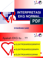 Ekg Normal Bcls Anca