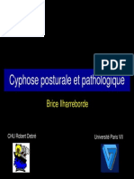 cyphose