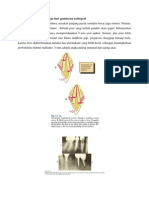 Panjang Kerja, Perbedaan Prefab Dan Fab