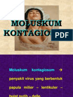 Moluskum-kontagiosum-asnawi