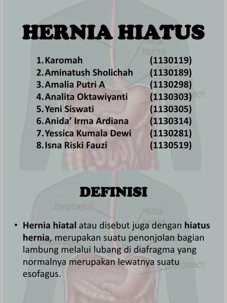 Hernia Hiatus | PDF