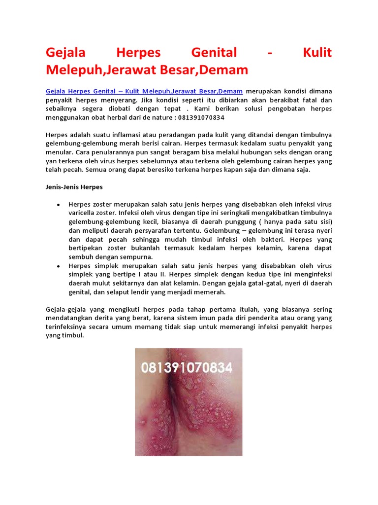 Gejala Herpes Genital Kulit Melepuh Jerawat Besar Demam