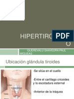 Hipertiroidismo-Paul Miqueas Querevalu Saavedra