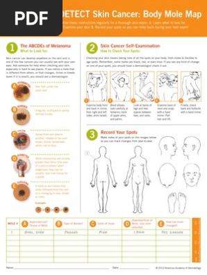 body mole map 2013