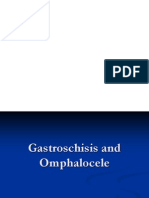 Gastroschisis and Omphalocele: Prenatal Diagnosis and Treatment